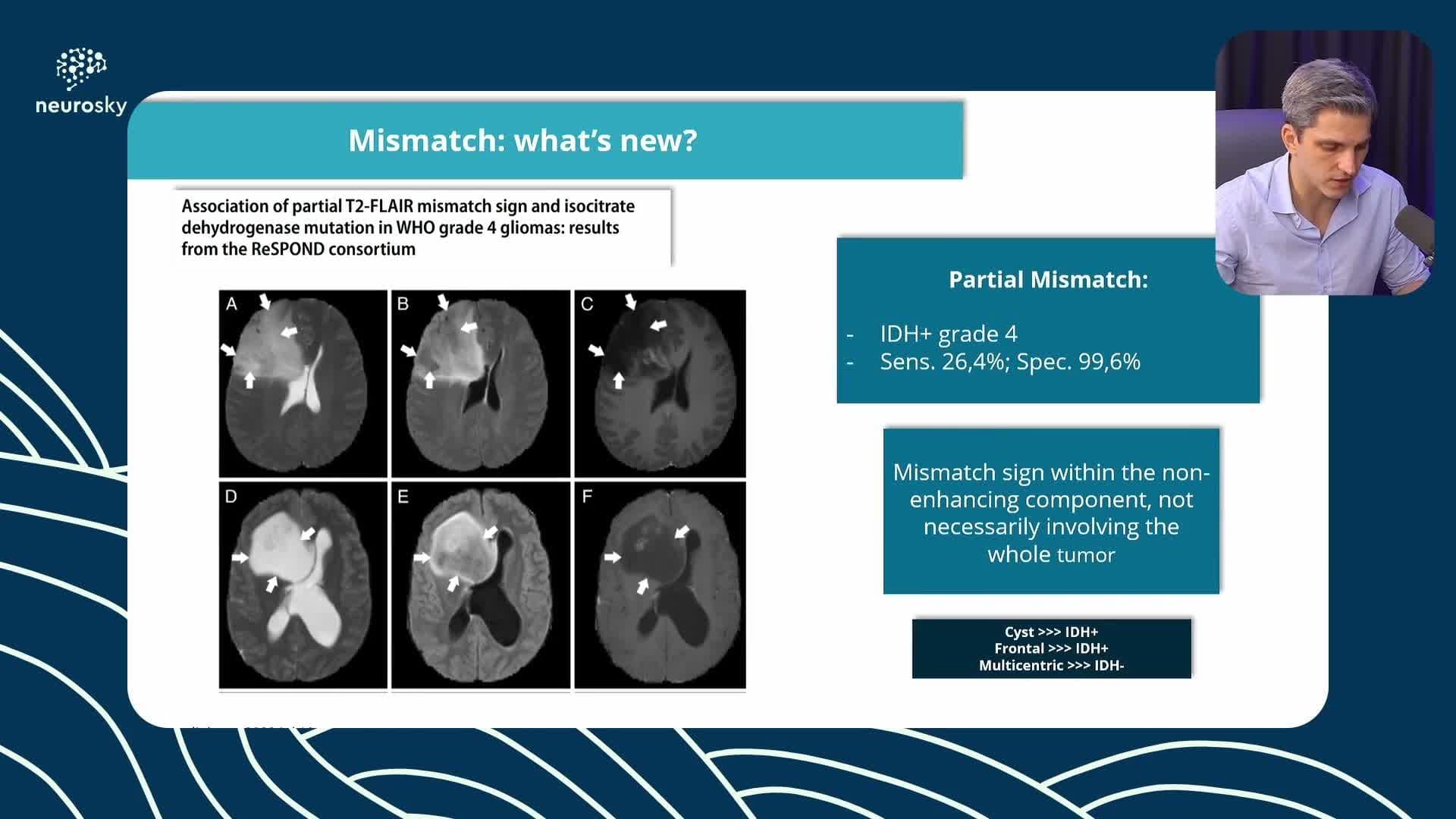 Glioma Difuso Adulto de Baixo Grau 2026 Parte 1