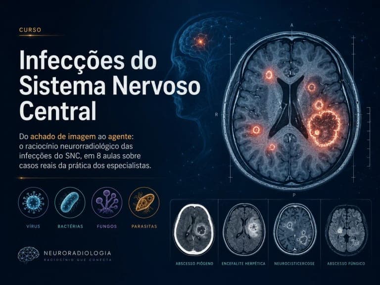 Infecções do Sistema Nervoso Central
