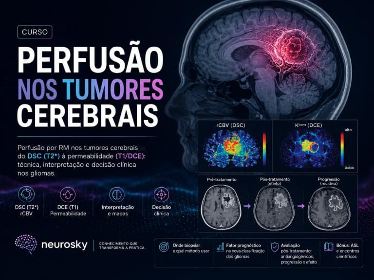 Perfusão nos Tumores Cerebrais