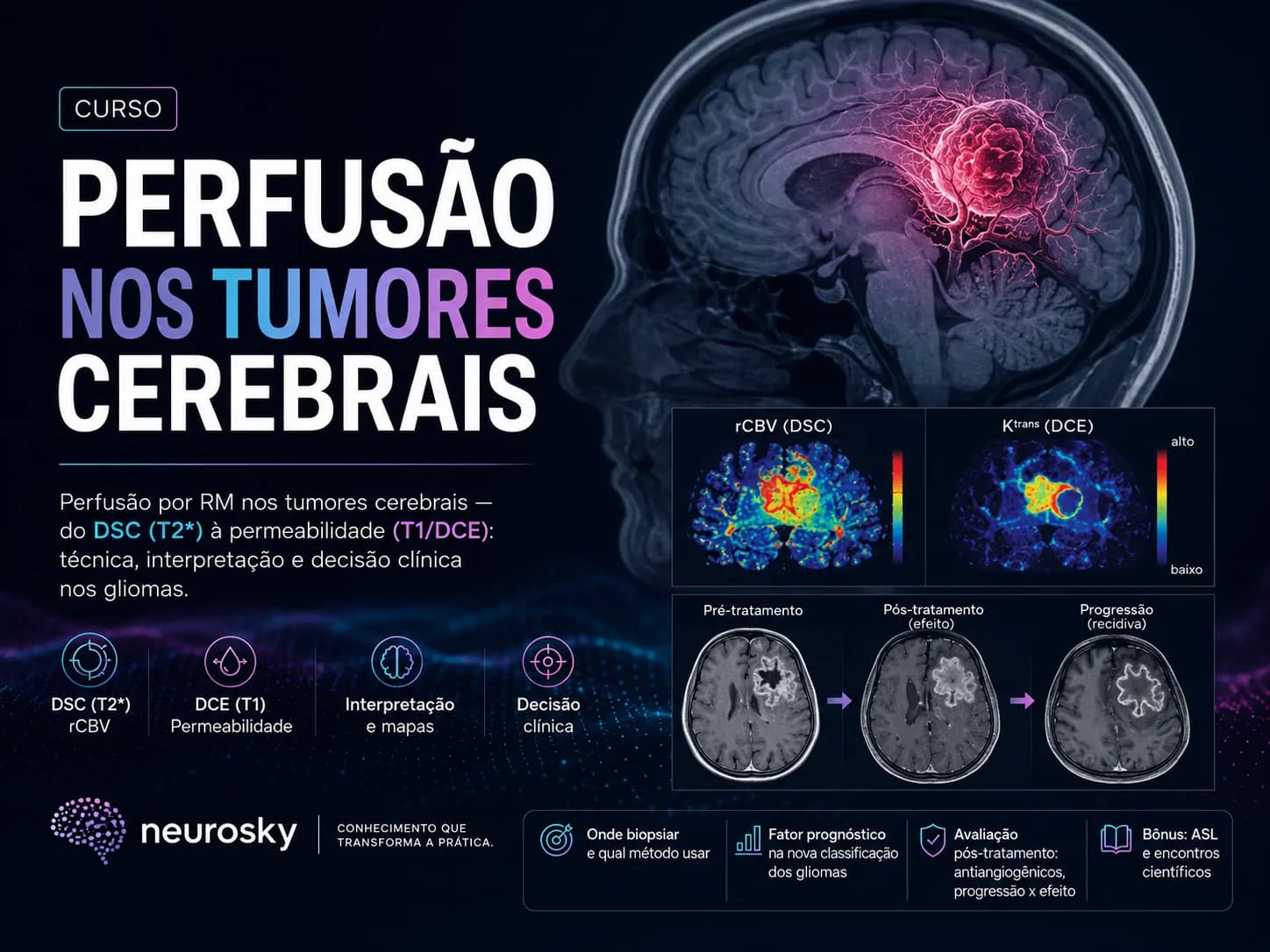 Capa do curso Perfusão nos Tumores Cerebrais