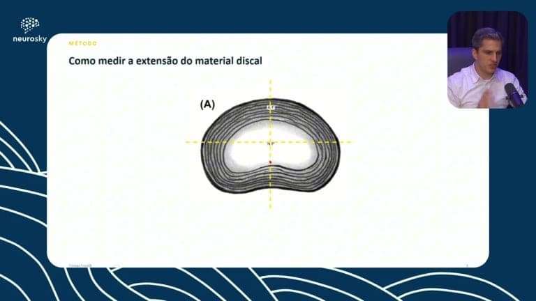 Diferença entre Abaulamento Discal e Hérnia