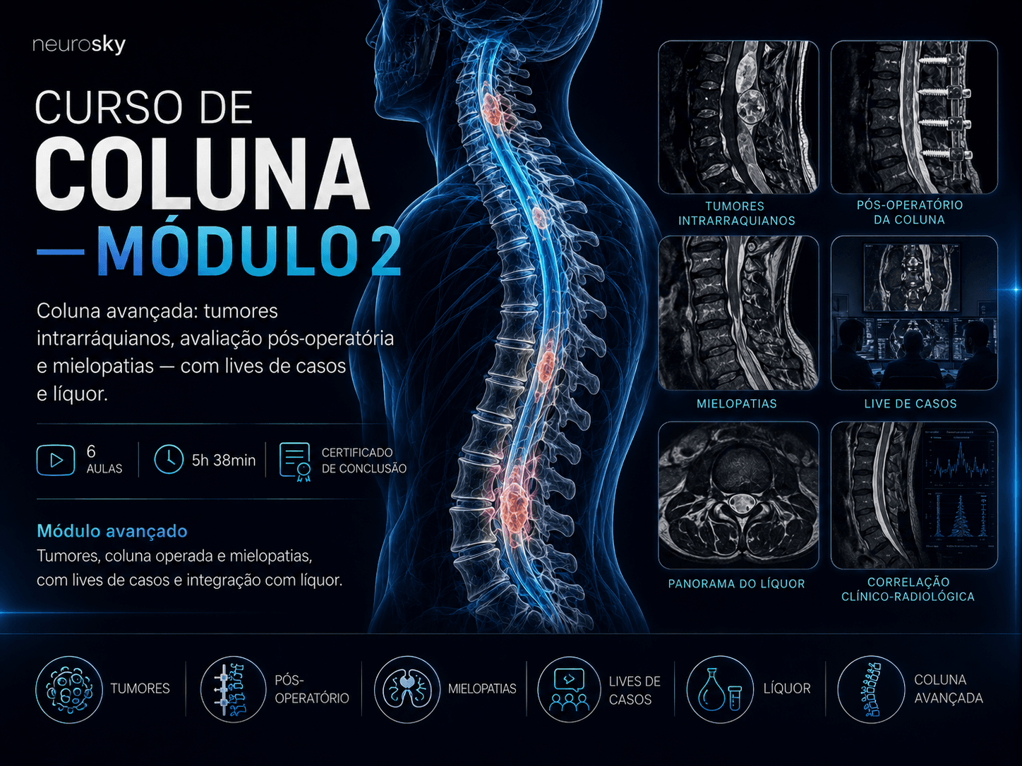 Capa do curso Curso de Coluna - Módulo 2