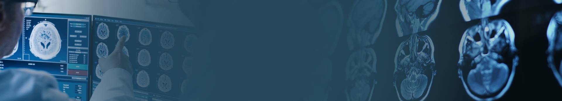 Perfusão nos Tumores Cerebrais