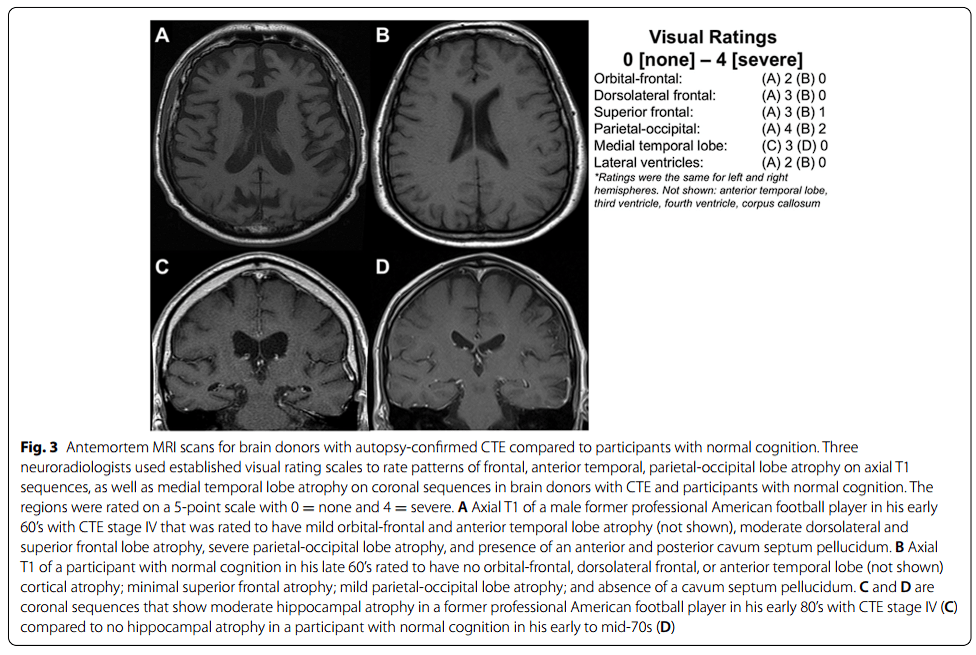 skycast 185 imagem 1