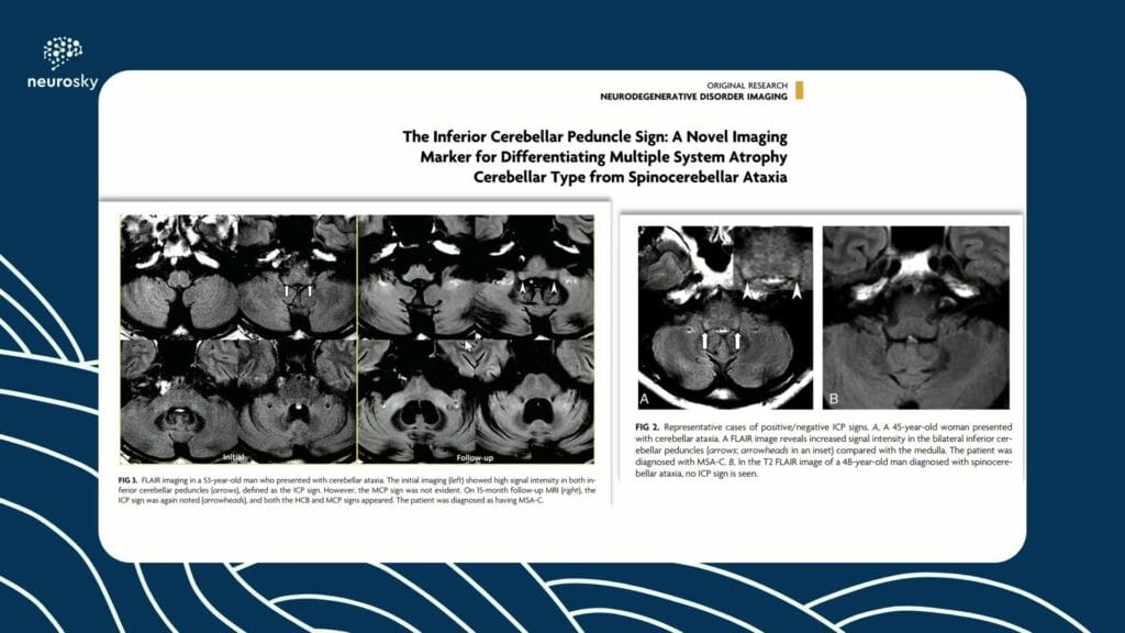 sinais neuroimagem pt2