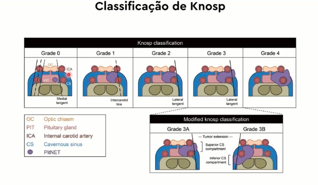 knosp aula1