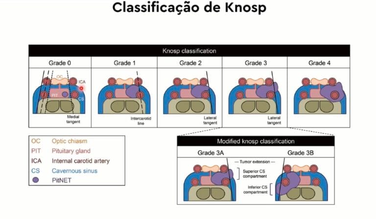 knosp aula1