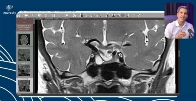 Avaliação RM Hipófise