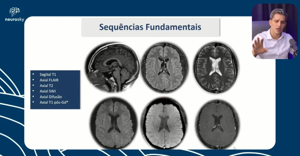 Protocolos de Exames de Neuroimagem Parte 1