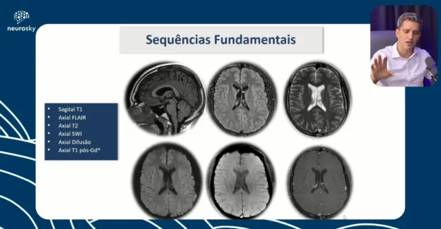 Protocolos de Exames de Neuroimagem - Parte 1