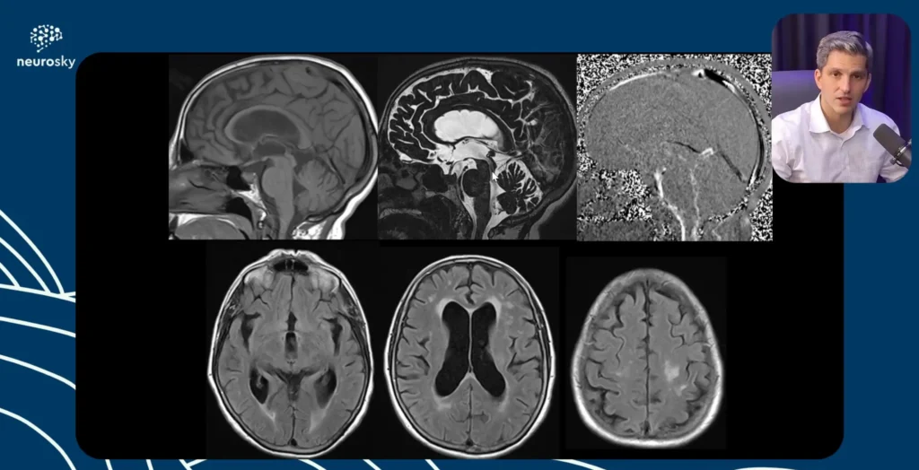 Protocolos de Exames de Neuroimagem Parte 2