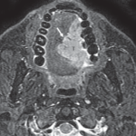 Logotipo do grupo de Cabeça e Pescoço