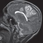 Group logo of Infecções