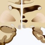 Group logo of Degenerativas